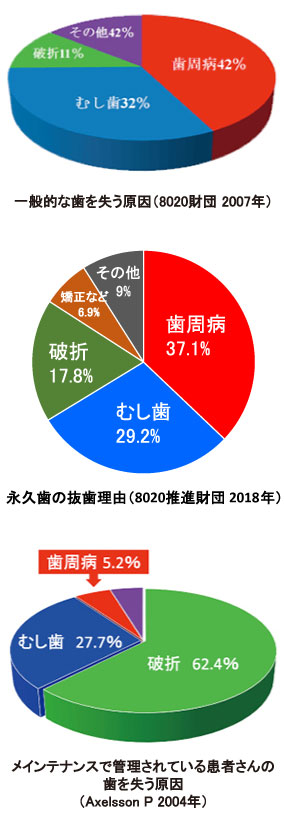 一般的な歯を失う原因